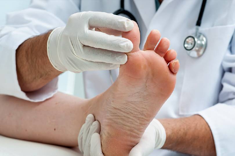 Hammertoe Correction