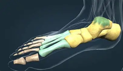 Metatarsal bone realignment