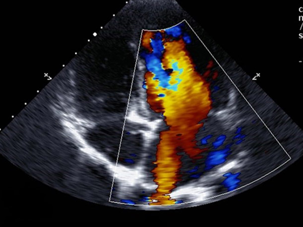 Nalam Hospital Cardiac Care